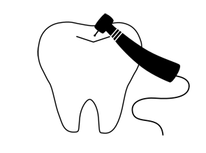 歯を削るイメージ（＊イラスト：hatorinaさん）