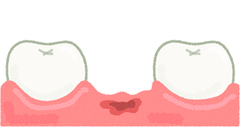 歯の点検のイメージ（＊イラスト：佐桃冬雪さん）