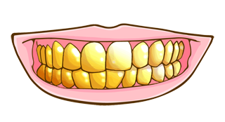 金歯のイメージ（＊イラスト：レウランさん）