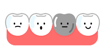 銀歯のイメージ（＊イラスト：もんちゃんさん）