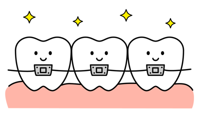 歯の矯正のｲメージ（＊イラスト：ののさん）